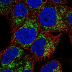 MAO-A Antibody, Novus Biologicals 25 &mu;L, Unlabeled:Antibodies, Polyclonal